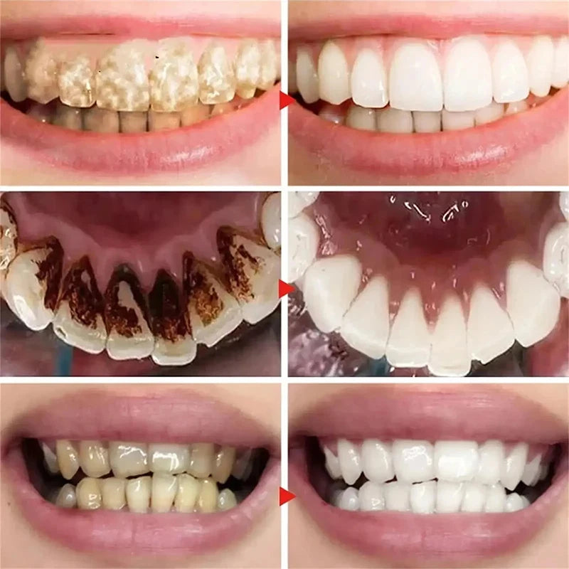 Novo creme dental clareador dental 5D bastão clareador dental higiene bucal limpeza clareamento dental ferramenta hálito fresco cuidados com os dentes novo