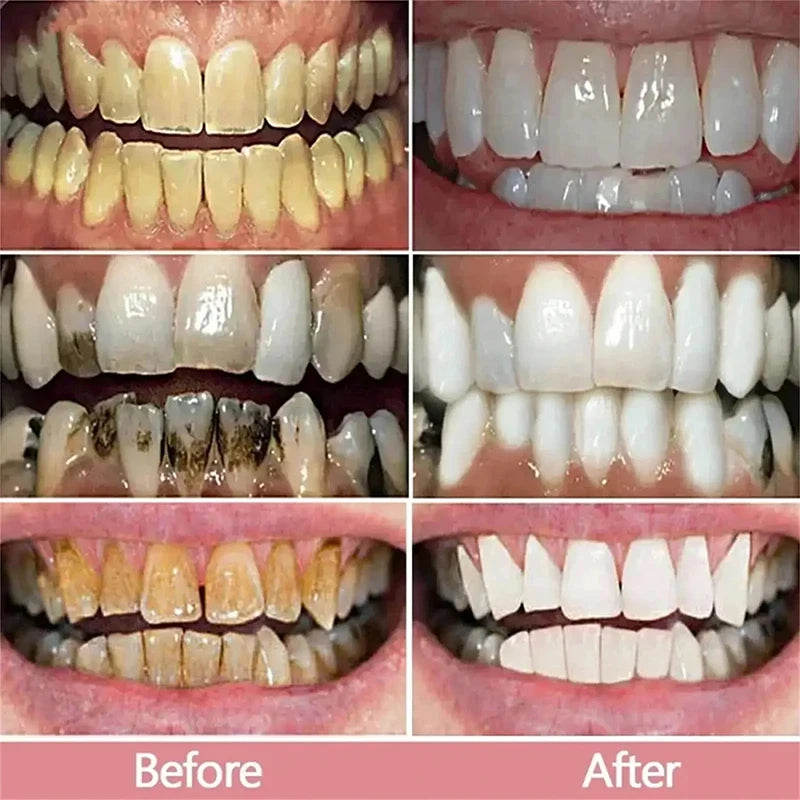 Novo creme dental clareador dental 5D bastão clareador dental higiene bucal limpeza clareamento dental ferramenta hálito fresco cuidados com os dentes novo