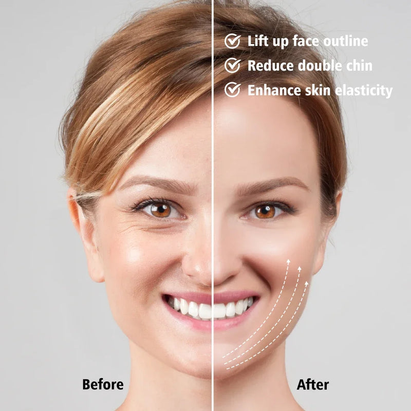 Massageador facial EMS, antirrugas, firmador, dispositivo de lifting facial em V, removedor de microcorrente, cuidados com a pele do queixo duplo