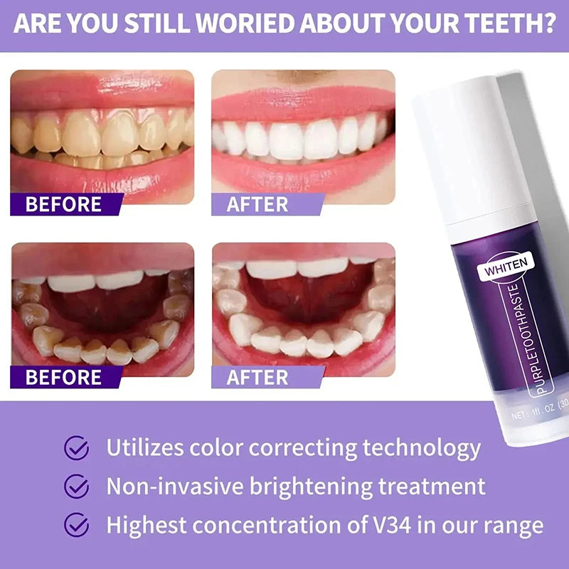 Novo creme dental clareador dental 5D bastão clareador dental higiene bucal limpeza clareamento dental ferramenta hálito fresco cuidados com os dentes novo
